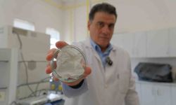 Hitit Üniversitesinden ithal kan şekeri ölçüm sensörlerine yerli ve milli alternatif