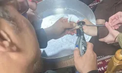 Batman'da vatandaşın parmağına sıkışan yüzük hastanede çıkarıldı