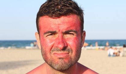 Uzmanlar uyardı: "Güneş çarpmasına dikkat edin"