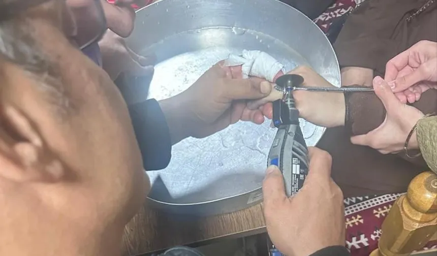 Batman'da vatandaşın parmağına sıkışan yüzük hastanede çıkarıldı